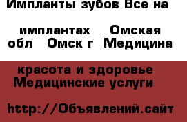 Импланты зубов Все на 4 имплантах. - Омская обл., Омск г. Медицина, красота и здоровье » Медицинские услуги   